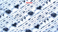 Size 1 Maxaloones: Girl Prints-Fruit of the Womb Diapers